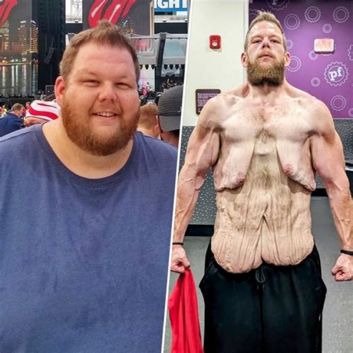 Zach Galifianakis Shows off His 50-Pound Weight Loss — “Being Light’s Fun!”